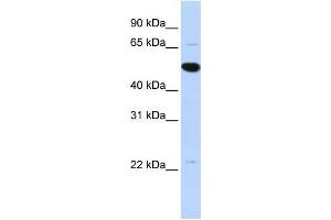 Human MCF-7; WB Suggested Anti-RP13-102H20.