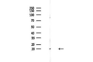 Western blot analysis of lysates from PC12 cells(starvation,24h treatment), using HSP Antibody at 1/1000 dilution.