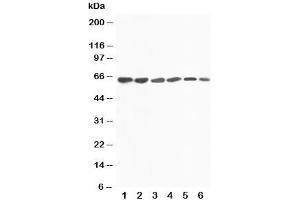 Western blot testing of FMO4 antibody and Lane 1:  rat liver;  2: mouse liver;  3: human SMMC-7721;  4: (m) HEPA;  5: (h) A431;  6: (h) MCF-7 cell lysate. (FMO4 anticorps  (N-Term))
