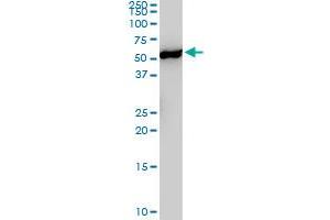YES1 monoclonal antibody (M02), clone 3C6.
