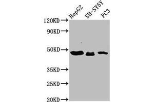 Western Blot Positive WB detected in: HepG2 whole cell lysate, SH-SY5Y whole cell lysate, PC-3 whole cell lysate All lanes: CXorf36 antibody at 3. (CXORF36 anticorps  (AA 311-405))