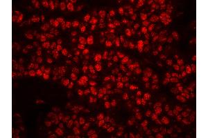 Immunofluorescence (IF) image for anti-Replication Protein A2, 32kDa (RPA2) (pSer4), (pSer8) antibody (ABIN7449013) (RPA2 anticorps  (pSer4, pSer8))