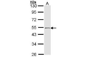 WB Image Sample (30 ug of whole cell lysate) A: 293T 10% SDS PAGE antibody diluted at 1:1000 (RNF13 anticorps  (C-Term))