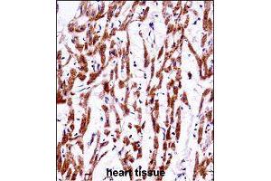 Immunohistochemistry (Formalin/PFA-fixed paraffin-embedded sections) of human heart tissue with TMEM85 polyclonal antibody  followed by peroxidase conjugation of the secondary antibody and DAB staining.