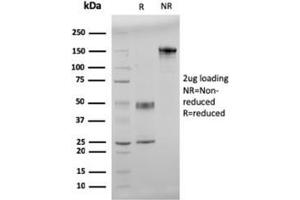 SDS-PAGE Analysis Purified Double Stranded DNA Mouse Monoclonal Antibody (121-3). (dsDNA anticorps)