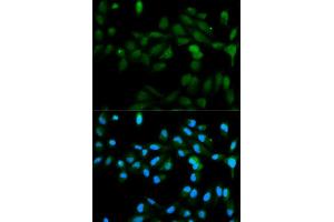 Immunofluorescence analysis of MCF7 cell using CYP11A1 antibody. (CYP11A1 anticorps  (AA 40-320))