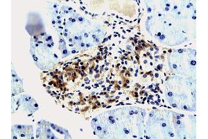 Formalin-fixed and paraffin embedded mouse pancreas tissue labeled with Anti IMP3 IGF-IIBP3 Polyclonal Antibody, unconjugated (ABIN674814) at 1:200 followed by incubation with conjugated secondary antibody and DAB staining (IGF2BP3 anticorps  (AA 101-230))