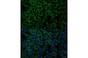 Immunofluorescence analysis of C6 cells using MTIF2 Polyclonal Antibody (ABIN7268591) at dilution of 1:100 (40x lens).