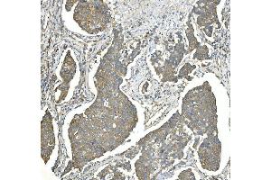 IHC analysis of EEF2 using anti-EEF2 antibody (ABIN7603141). (EEF2 anticorps  (N-Term))