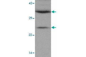 Western blot analysis of CXXC5 in human brain tissue lysate with CXXC5 polyclonal antibody  at 1 ug/mL.