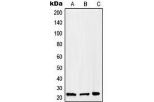 Western blot analysis of RAB2B expression in HepG2 (A), A375 (B), Raw264. (RAB2B anticorps  (Center))