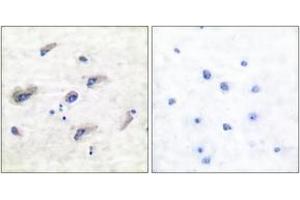 Immunohistochemistry (IHC) image for anti-Microtubule-Associated Protein tau (MAPT) (pSer356) antibody (ABIN2888546) (MAPT anticorps  (pSer356))