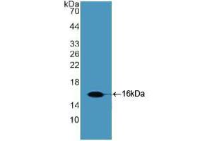 Western blot analysis of recombinant Human Slit2. (SLIT2 anticorps  (AA 1416-1528))