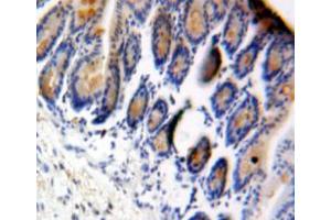 Used in DAB staining on fromalin fixed paraffin-embedded bowels tissue (eIF4EBP1 anticorps  (AA 2-117))