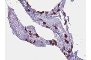 ABIN6267424 at 1/100 staining human lung tissue sections by IHC-P.