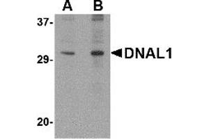 Western Blotting (WB) image for anti-Dynein, Axonemal, Light Chain 1 (DNAL1) (C-Term) antibody (ABIN1030363) (DNAL1 anticorps  (C-Term))