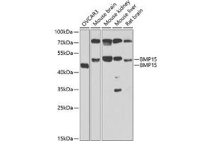 Western blot analysis of extracts of various cell lines, using BMP15 antibody (ABIN6127524, ABIN6137593, ABIN6137594 and ABIN6223163) at 1:1000 dilution. (BMP15 anticorps  (AA 143-392))