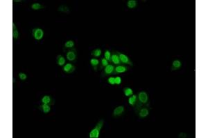 Immunofluorescence staining of PC-3 cells with ABIN7152540 at 1:100, counter-stained with DAPI.