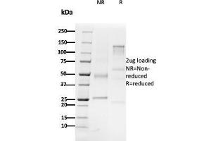 SDS-PAGE Analysis Purified CD79b Mouse Monoclonal Antibody (B29/123).
