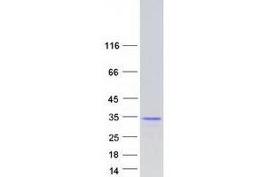 Validation with Western Blot