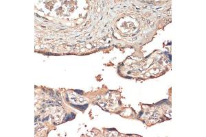Immunohistochemistry of paraffin-embedded human placenta using MSP/MST1 antibody (ABIN6132374, ABIN6144095, ABIN6144096 and ABIN6216790) at dilution of 1:200 (40x lens). (MST1 anticorps  (AA 200-500))