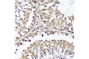Immunohistochemistry of paraffin-embedded rat testis using METTL4 Rabbit pAb (ABIN6133091, ABIN6143773, ABIN6143774 and ABIN6224964) at dilution of 1:100 (40x lens). (METTL4 anticorps  (AA 1-190))