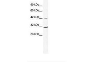 Image no. 1 for anti-Cyclin D3 (CCND3) (C-Term) antibody (ABIN6735965)