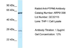 Western Blotting (WB) image for anti-Protein-tyrosine Phosphatase 1C (PTPN6) (Middle Region) antibody (ABIN2788789) (SHP1 anticorps  (Middle Region))