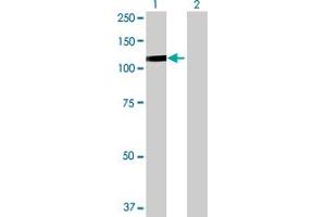 Western Blot analysis of DDX54 expression in transfected 293T cell line by DDX54 MaxPab polyclonal antibody. (DDX54 anticorps  (AA 1-881))