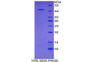 SDS-PAGE analysis of Rat PRG2 Protein. (Major Basic Protein Protéine)