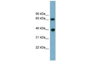 WB Suggested Anti-CCNJ Antibody Titration: 0. (Cyclin J anticorps  (N-Term))