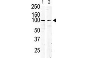 Western Blotting (WB) image for anti-Mast/stem Cell Growth Factor Receptor (KIT) antibody (ABIN5014921) (KIT anticorps)