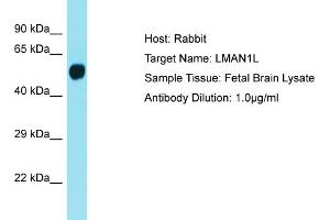 Host: Rabbit Target Name: LMAN1L Sample Tissue: Human Fetal Brain Antibody Dilution: 1ug/ml (LMAN1L anticorps  (Middle Region))