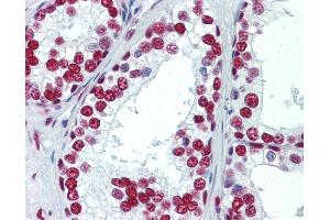 Anti-SAE1 antibody IHC staining of human prostate. (SAE1 anticorps)