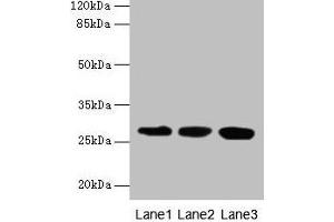 Western blot All lanes: KHDC1 antibody at 5 μg/mL Lane 1: Mouse liver tissue Lane 2: Mouse kidney tissue Lane 3: Mouse gonadal tissue Secondary Goat polyclonal to rabbit IgG at 1/10000 dilution Predicted band size: 28, 19 kDa Observed band size: 28 kDa