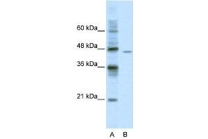 WB Suggested Anti-DDX25  Antibody Titration: 0. (DDX25 anticorps  (C-Term))