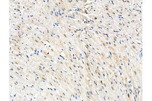 anti-Ryanodine Receptor 2 (Cardiac) (RYR2) (pSer2030) antibody