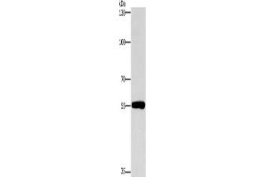 Gel: 8 % SDS-PAGE, Lysate: 40 μg, Lane: Human lymphoma tissue, Primary antibody: ABIN7190422(CYP46A1 Antibody) at dilution 1/200, Secondary antibody: Goat anti rabbit IgG at 1/8000 dilution, Exposure time: 1 minute (CYP46A1 anticorps)