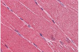 Human Skeletal Muscle: Formalin-Fixed, Paraffin-Embedded (FFPE) (EDEM2 anticorps  (AA 479-579))