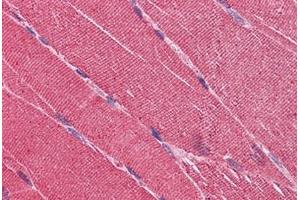 Human Skeletal Muscle: Formalin-Fixed, Paraffin-Embedded (FFPE)