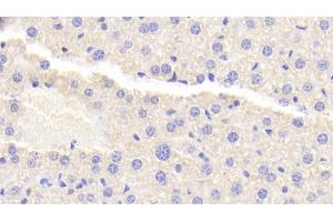 Detection of TNIP2 in Mouse Liver Tissue using Polyclonal Antibody to Tumor Necrosis Factor Alpha Induced Protein 3 Interacting Protein 2 (TNIP2) (TNIP2 anticorps  (AA 170-413))
