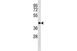 Olig2 antibody western blot analysis in mouse heart tissue lysate.