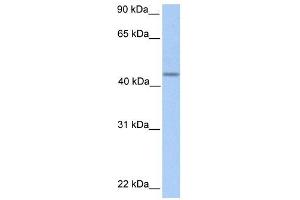 PNPLA5 antibody used at 1 ug/ml to detect target protein. (PNPLA5 anticorps  (C-Term))