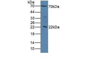 Figure. (IL1RAP anticorps  (AA 420-558))