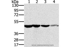Western blot analysis of HT-29 cell and human normal kidney tissue, Lo2 cell and human normal liver tissue, human fetal brain tissue, using RNH1 Polyclonal Antibody at dilution of 1:400 (RNH1 anticorps)