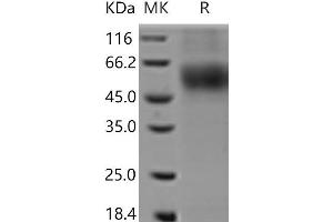 Western Blotting (WB) image for Macrophage Scavenger Receptor 1 (MSR1) protein (His tag) (ABIN7321106) (Macrophage Scavenger Receptor 1 Protein (MSR1) (His tag))