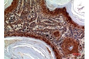 Immunohistochemical analysis of paraffin-embedded human-skin, antibody was diluted at 1:100 (CCL27 anticorps  (Internal Region))