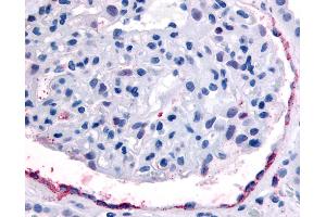 Anti-EPHA4 antibody IHC of human kidney, glomerulus. (EPH Receptor A4 anticorps  (Internal Region))