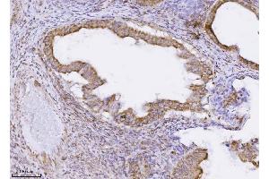 IHC analysis of PMPCB using anti-PMPCB antibody (ABIN7600757). (PMPCB anticorps  (AA 23-479))