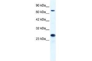 WB Suggested Anti-MCM6 Antibody Titration:  1.